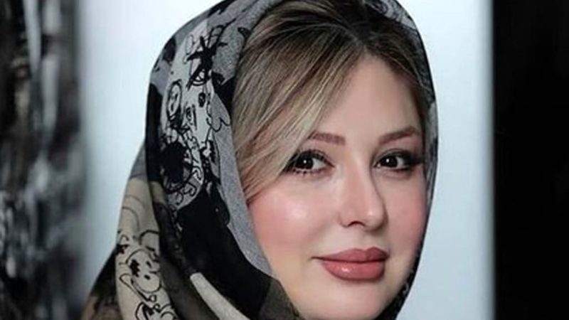 عکس چهره متفاوت نیوشا ضیغمی بعد از عمل و تزریق ! 